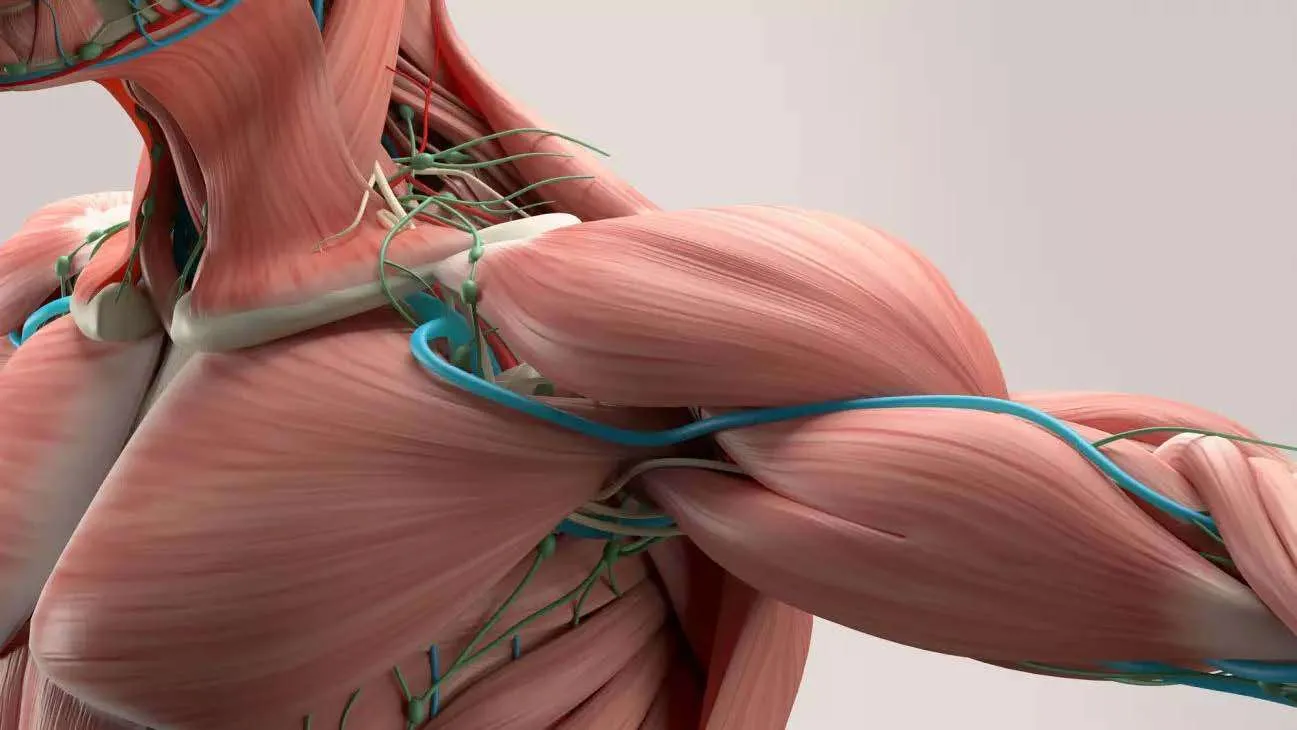 What is thoracic outlet syndrome?