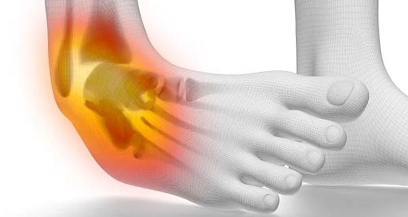 Ankle Injury in Sports: Causes, Treatment