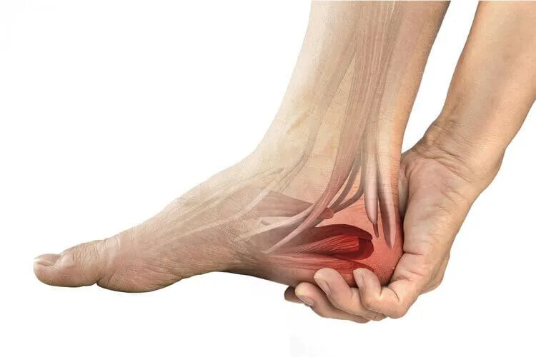 Heel pain - Symptoms, Treatment, and Prevention